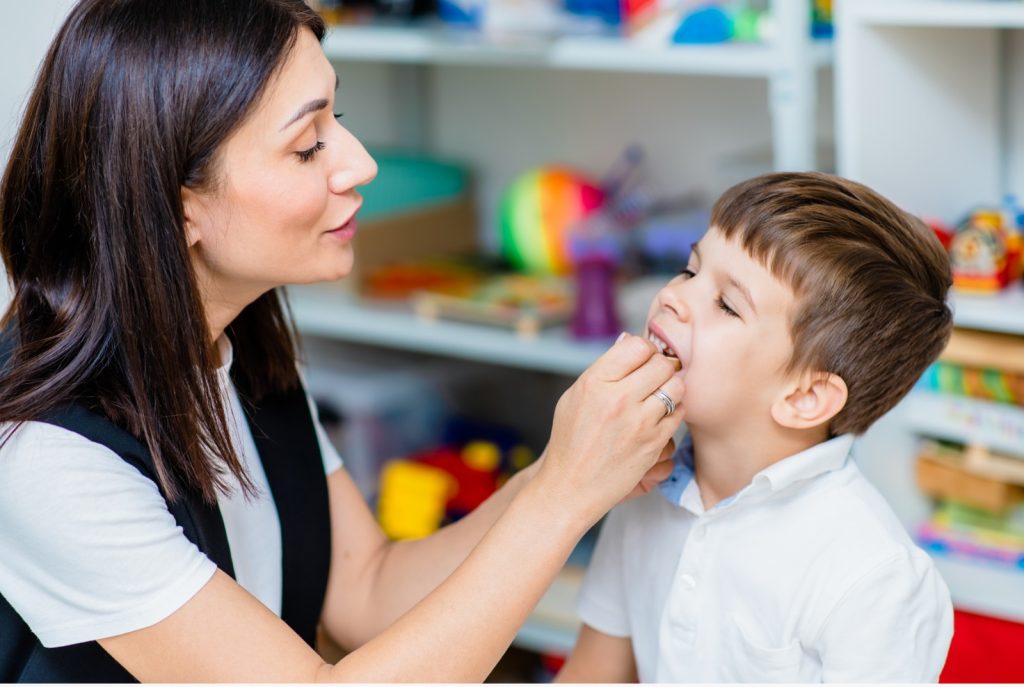 Oral Motor Therapy (6)
